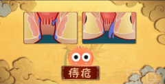 血栓性外痔能消下去吗?