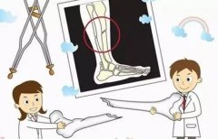 【骨科科普】 | 石狮现代医院骨伤科医