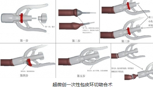 1.png 图片