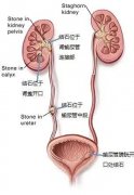 让人痛彻心扉的小石头，该拿它怎么办