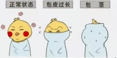 割包皮疼不疼？包皮手术请选择正规医