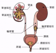 石狮人注意啦！“石”在难忍，无需再