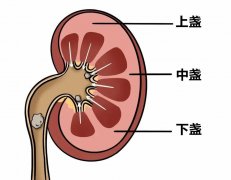 多大的尿结石能够顺利排出来？