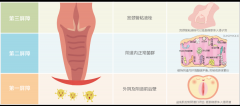 女性常见妇科疾病及预防措施