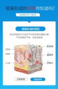 这个引起狐臭的原因，很多石狮人都中