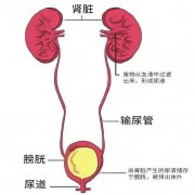 结石不大不小，究竟能不能自己排出？